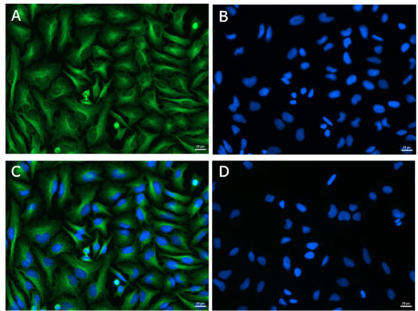 Immunofluorescence of Rabbit Anti-Alpha Tubulin Antibody